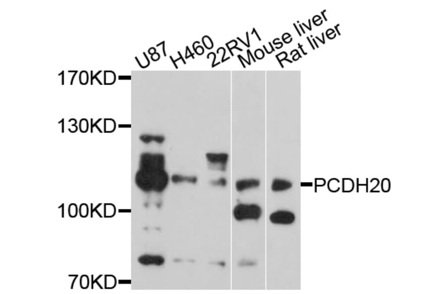 Western Blot - Anti-PCDH20 Antibody (A10428) - Antibodies.com