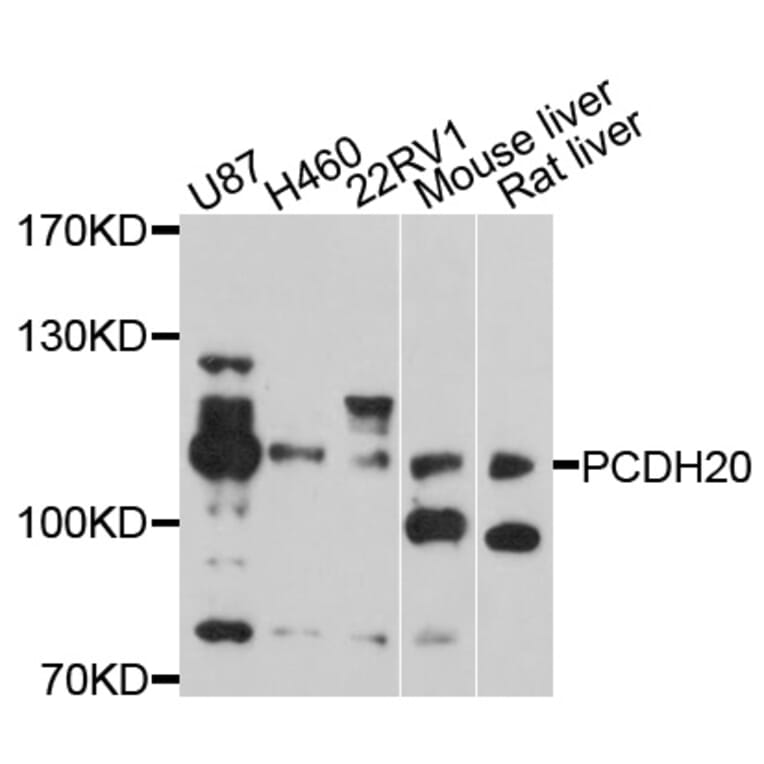 Western Blot - Anti-PCDH20 Antibody (A10428) - Antibodies.com