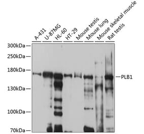 Western Blot - Anti-Cytosolic Phospholipase A2 Antibody (A12933) - Antibodies.com