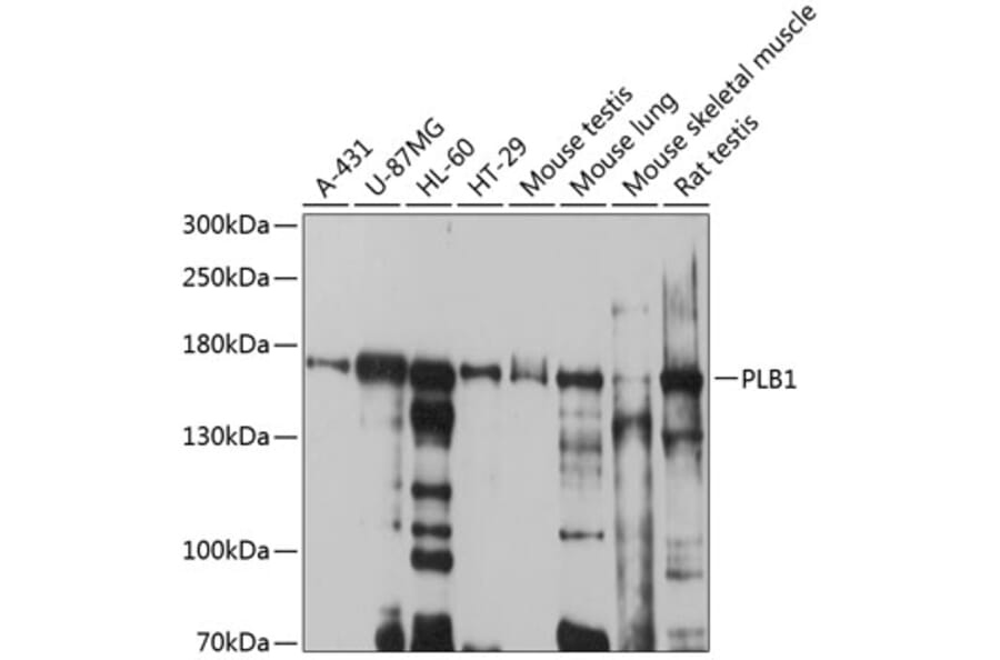 Western Blot - Anti-Cytosolic Phospholipase A2 Antibody (A12933) - Antibodies.com