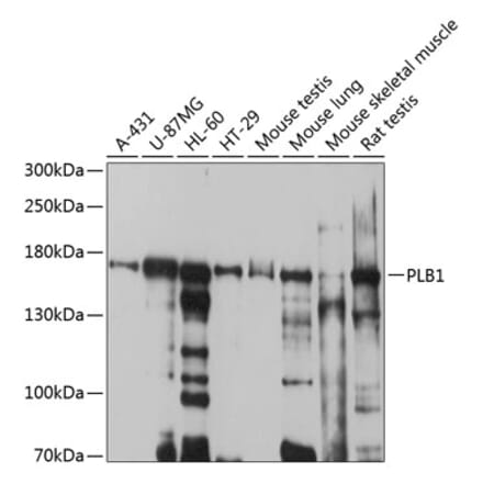 Western Blot - Anti-Cytosolic Phospholipase A2 Antibody (A12933) - Antibodies.com