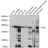 Western Blot - Anti-Cytosolic Phospholipase A2 Antibody (A12933) - Antibodies.com