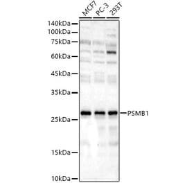 Western Blot - Anti-PSMB1 Antibody (A12934) - Antibodies.com