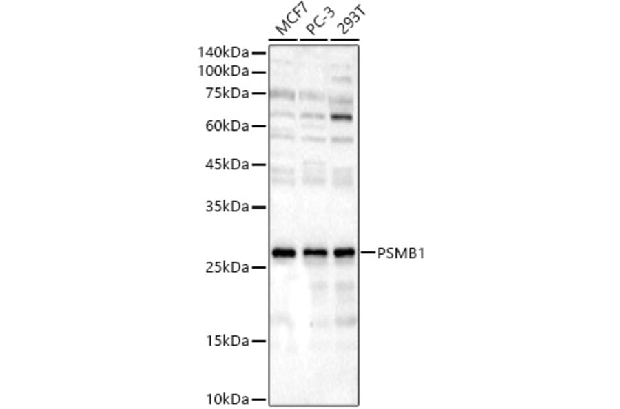 Western Blot - Anti-PSMB1 Antibody (A12934) - Antibodies.com