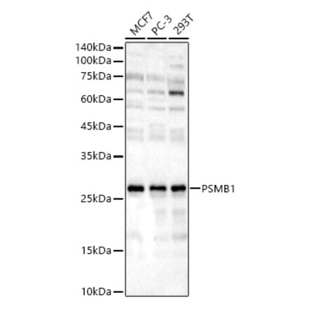 Western Blot - Anti-PSMB1 Antibody (A12934) - Antibodies.com