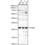 Western Blot - Anti-PSMB1 Antibody (A12934) - Antibodies.com