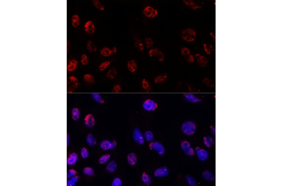 Immunofluorescence - Anti-PSMB1 Antibody (A12934) - Antibodies.com