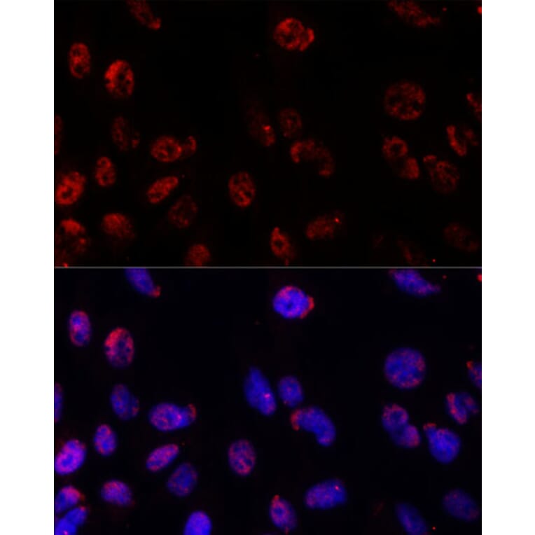 Immunofluorescence - Anti-PSMB1 Antibody (A12934) - Antibodies.com