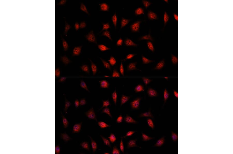 Immunofluorescence - Anti-PSMB1 Antibody (A12934) - Antibodies.com