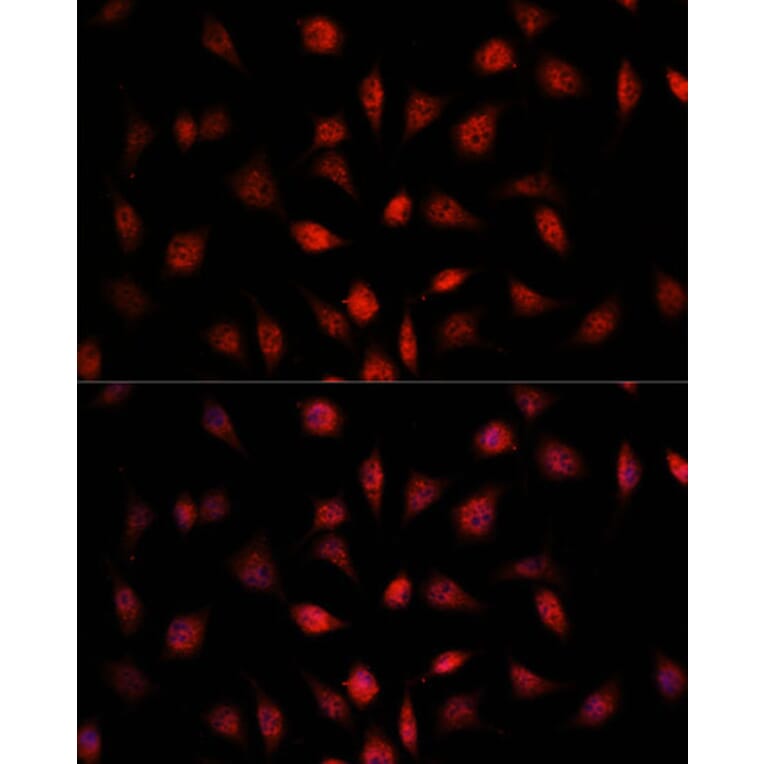 Immunofluorescence - Anti-PSMB1 Antibody (A12934) - Antibodies.com