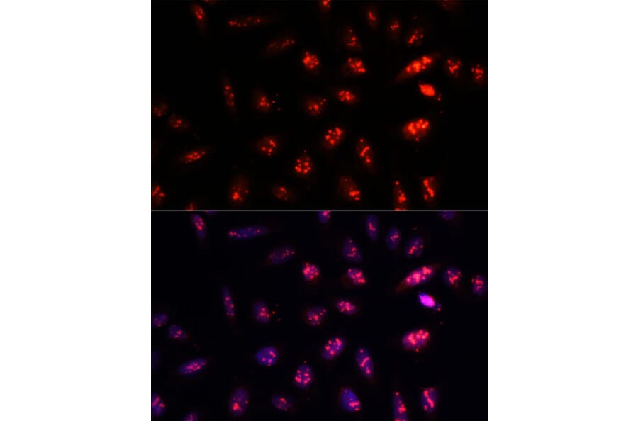 Immunofluorescence - Anti-PSMB1 Antibody (A12934) - Antibodies.com