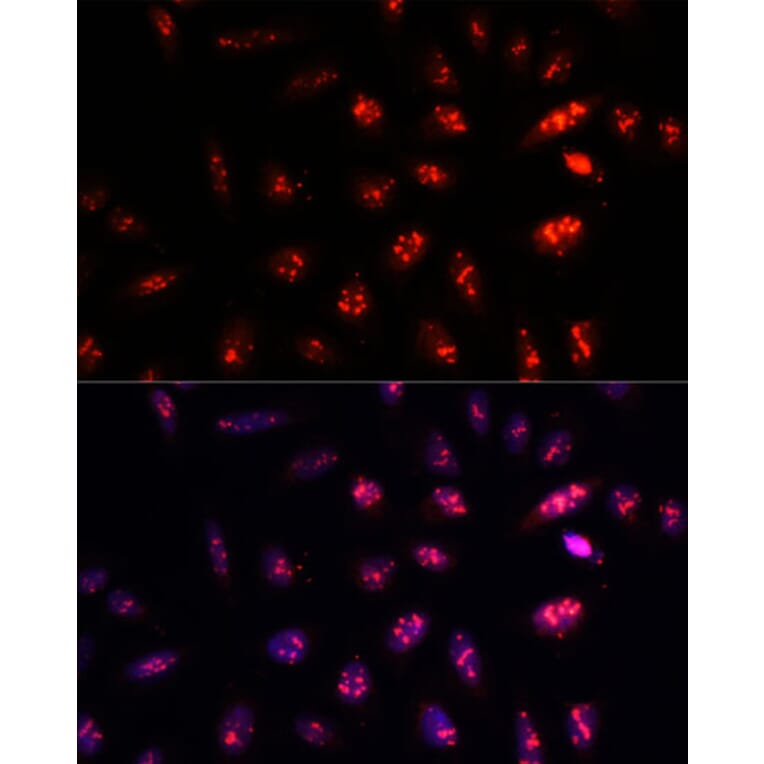 Immunofluorescence - Anti-PSMB1 Antibody (A12934) - Antibodies.com