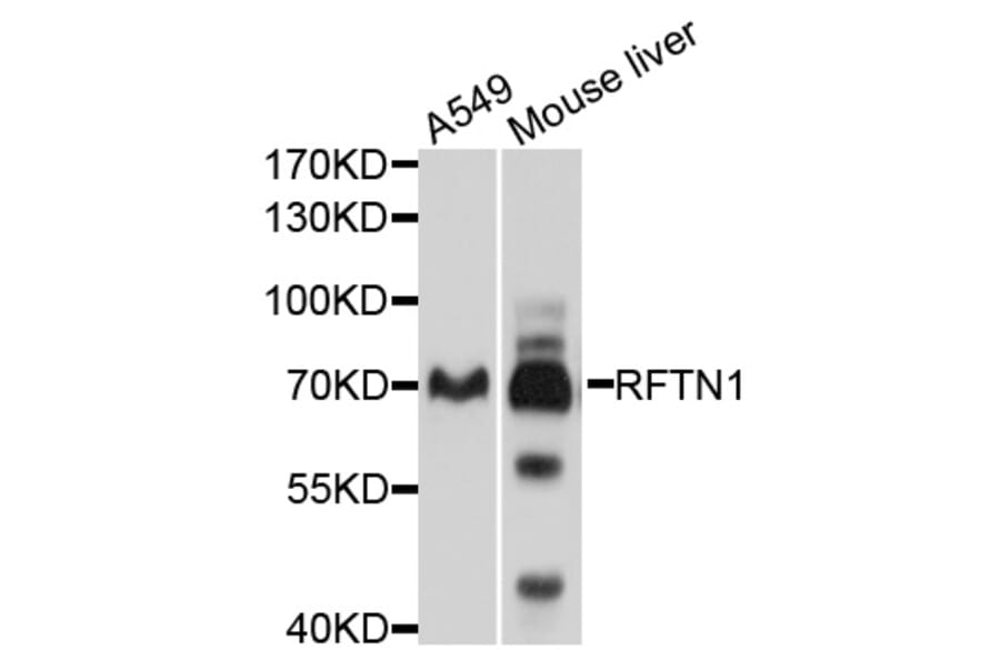 Western Blot - Anti-RFTN1 Antibody (A10430) - Antibodies.com