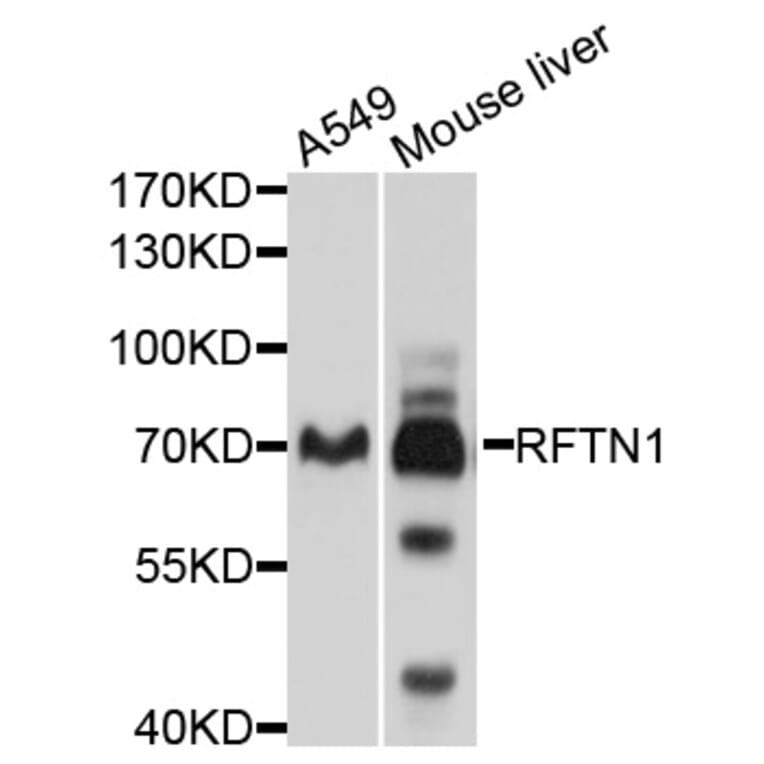 Western Blot - Anti-RFTN1 Antibody (A10430) - Antibodies.com