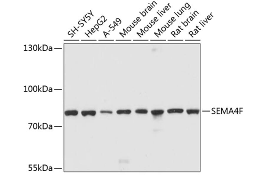 Western Blot - Anti-SEMA4F Antibody (A12936) - Antibodies.com