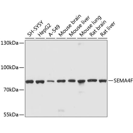 Western Blot - Anti-SEMA4F Antibody (A12936) - Antibodies.com