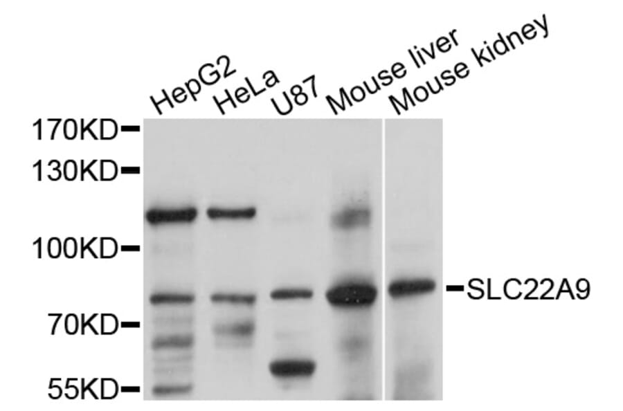 Western Blot - Anti-SLC22A9 Antibody (A10434) - Antibodies.com