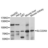 Western Blot - Anti-SLC22A9 Antibody (A10434) - Antibodies.com