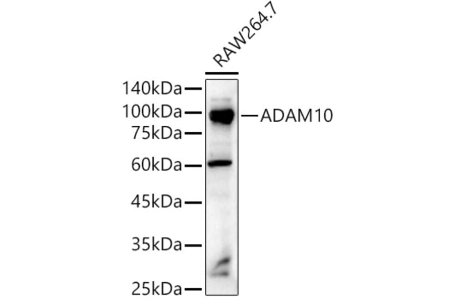 Anti-ADAM10 Antibody (A12938) | Antibodies.com