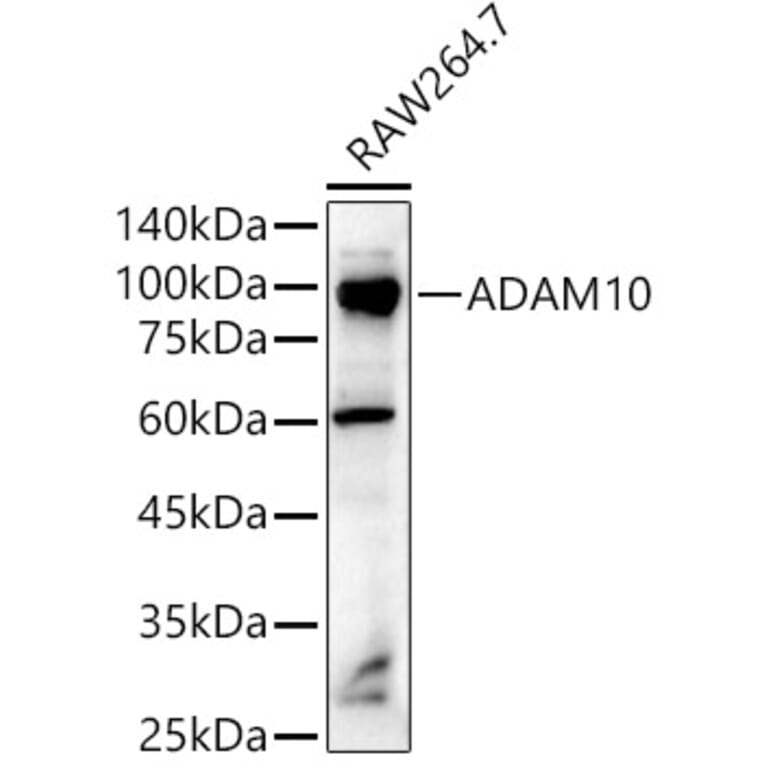 Western Blot - Anti-ADAM10 Antibody (A12938) - Antibodies.com