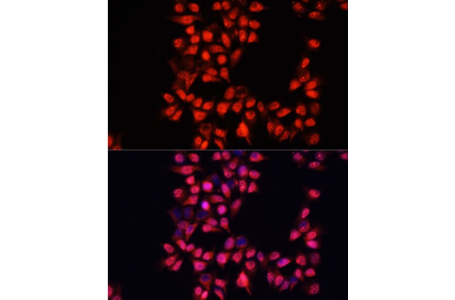 Immunofluorescence - Anti-ADAM10 Antibody (A12938) - Antibodies.com