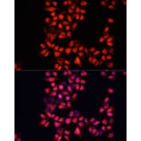 Immunofluorescence - Anti-ADAM10 Antibody (A12938) - Antibodies.com
