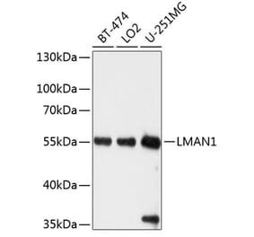 Western Blot - Anti-LMAN1 Antibody (A12940) - Antibodies.com