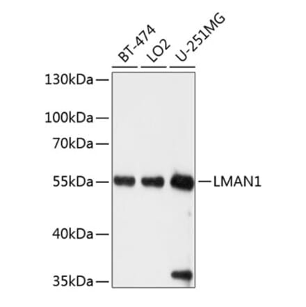 Western Blot - Anti-LMAN1 Antibody (A12940) - Antibodies.com