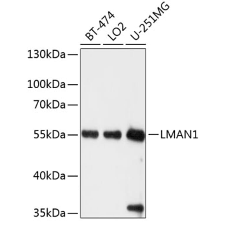 Western Blot - Anti-LMAN1 Antibody (A12940) - Antibodies.com