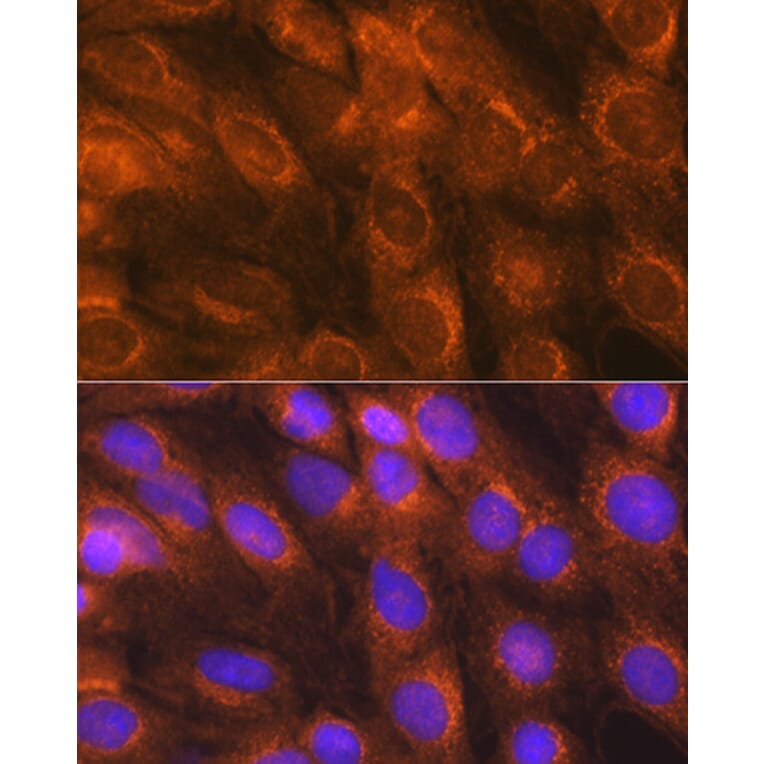 Immunofluorescence - Anti-LMAN1 Antibody (A12940) - Antibodies.com