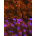 Immunofluorescence - Anti-LMAN1 Antibody (A12940) - Antibodies.com