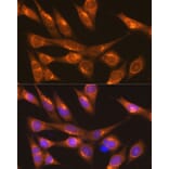 Immunofluorescence - Anti-LMAN1 Antibody (A12940) - Antibodies.com