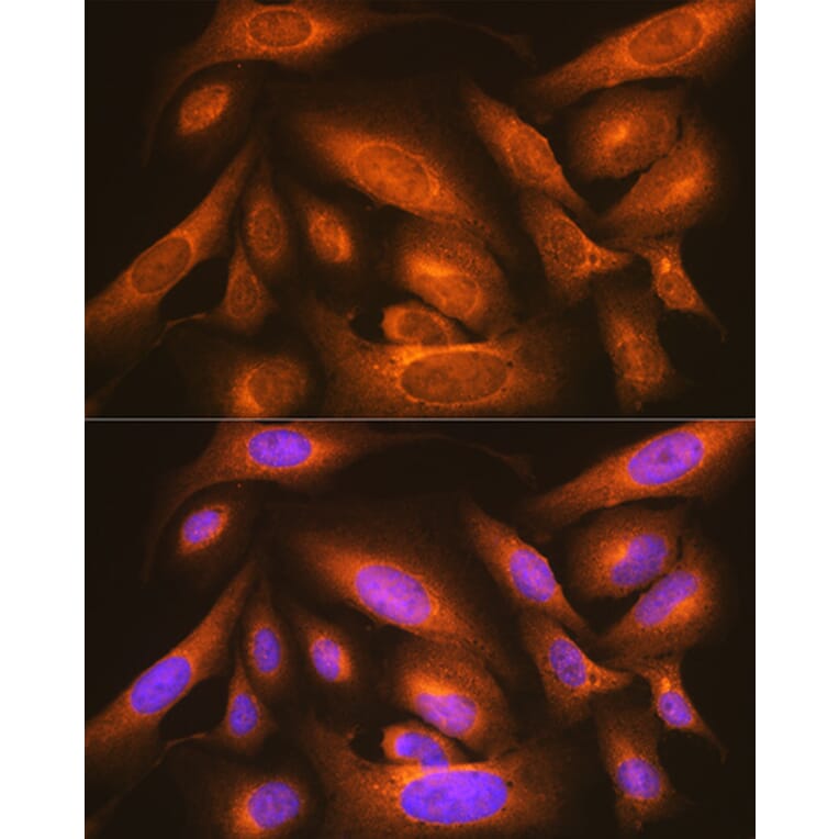 Immunofluorescence - Anti-LMAN1 Antibody (A12940) - Antibodies.com