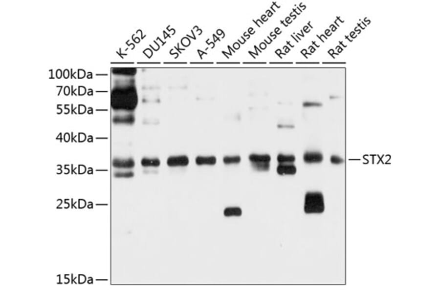 Western Blot - Anti-Syntaxin 2/STX2 Antibody (A12941) - Antibodies.com