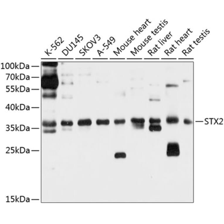 Western Blot - Anti-Syntaxin 2/STX2 Antibody (A12941) - Antibodies.com