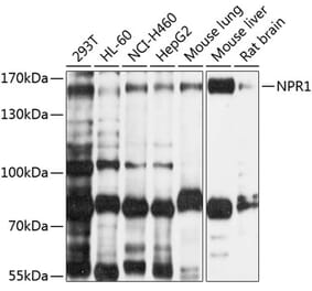 Western Blot - Anti-NPR-A Antibody (A12942) - Antibodies.com