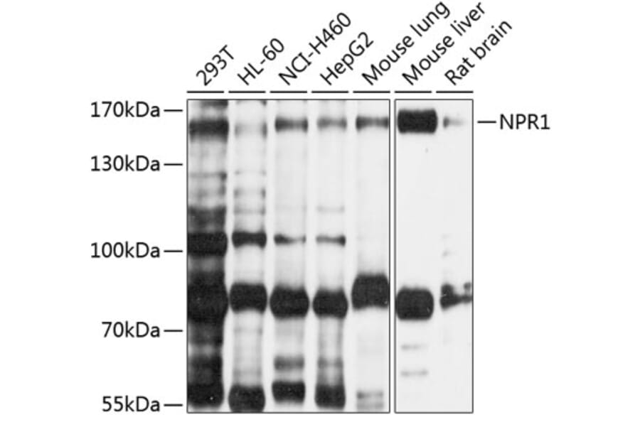 Western Blot - Anti-NPR-A Antibody (A12942) - Antibodies.com