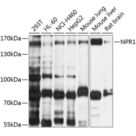 Western Blot - Anti-NPR-A Antibody (A12942) - Antibodies.com