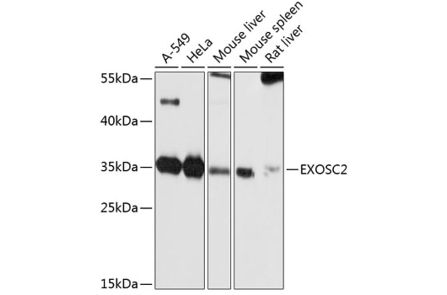 Western Blot - Anti-RRP4 Antibody (A12944) - Antibodies.com