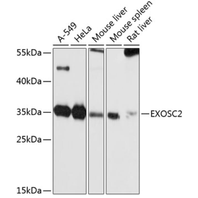 Western Blot - Anti-RRP4 Antibody (A12944) - Antibodies.com