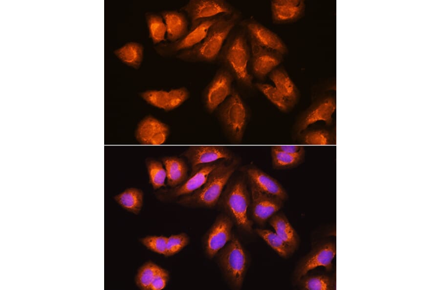 Immunofluorescence - Anti-RRP4 Antibody (A12944) - Antibodies.com