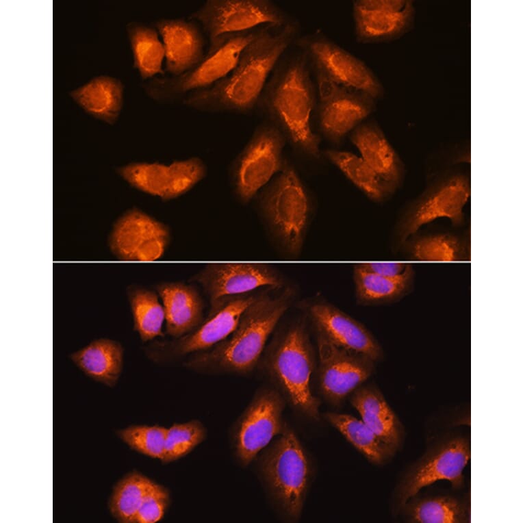 Immunofluorescence - Anti-RRP4 Antibody (A12944) - Antibodies.com