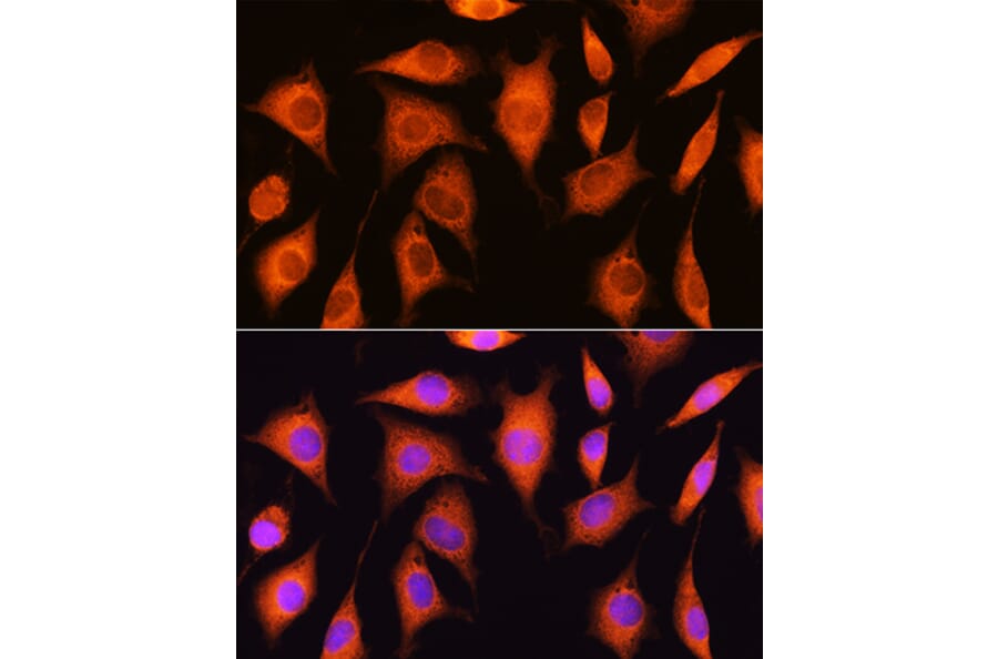 Immunofluorescence - Anti-RRP4 Antibody (A12944) - Antibodies.com