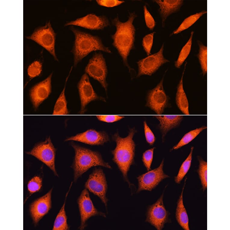 Immunofluorescence - Anti-RRP4 Antibody (A12944) - Antibodies.com
