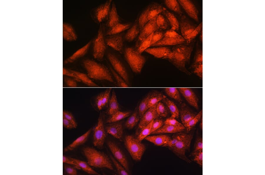 Immunofluorescence - Anti-RRP4 Antibody (A12944) - Antibodies.com