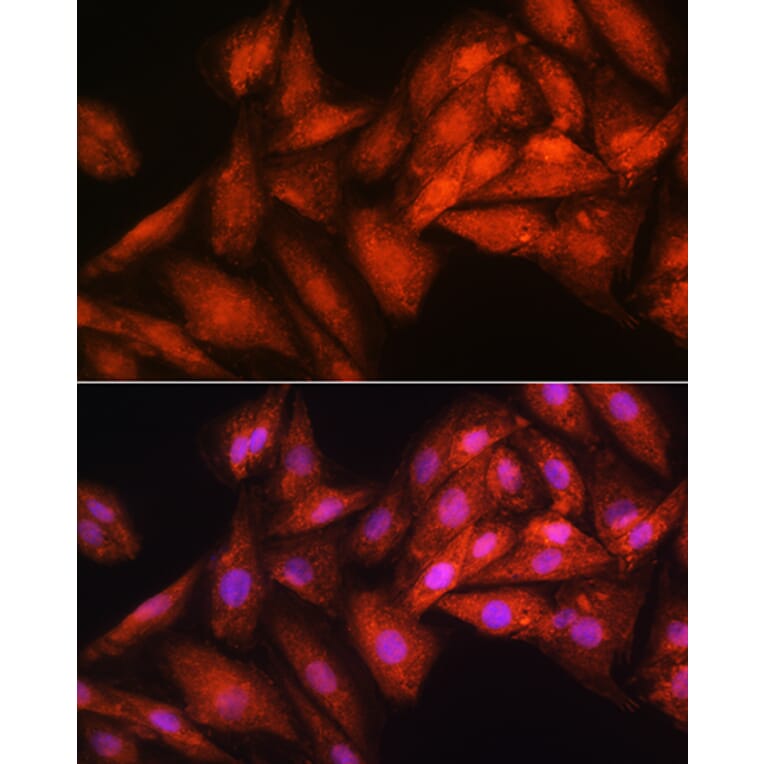 Immunofluorescence - Anti-RRP4 Antibody (A12944) - Antibodies.com