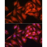Immunofluorescence - Anti-RRP4 Antibody (A12944) - Antibodies.com