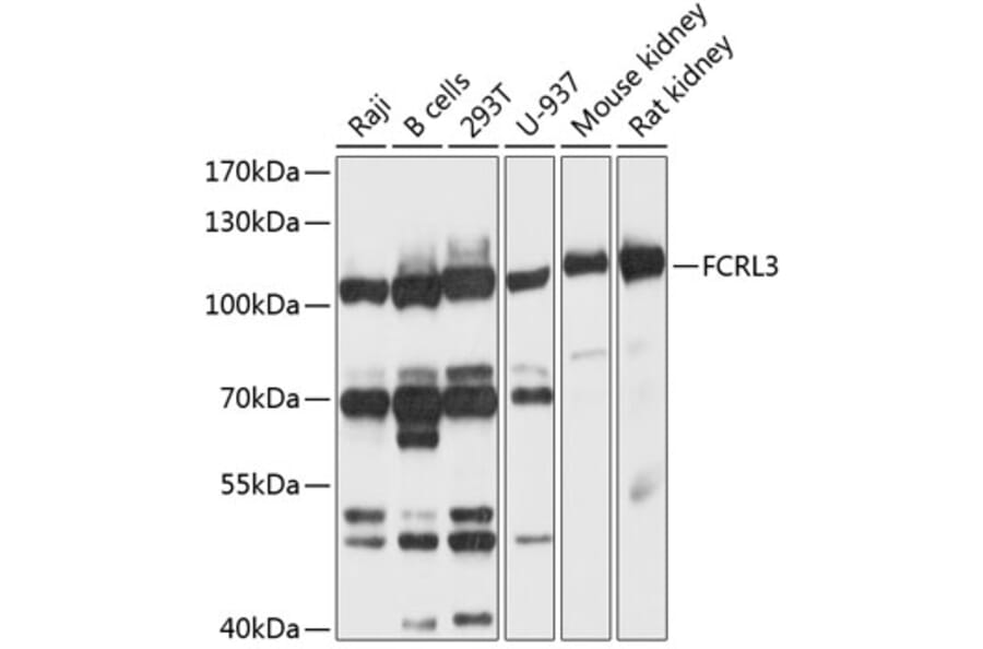 Western Blot - Anti-FCRL3 Antibody (A12945) - Antibodies.com