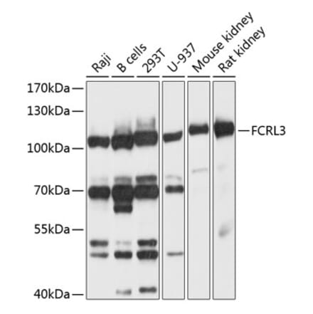 Western Blot - Anti-FCRL3 Antibody (A12945) - Antibodies.com