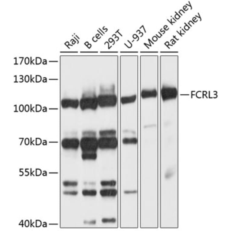 Western Blot - Anti-FCRL3 Antibody (A12945) - Antibodies.com